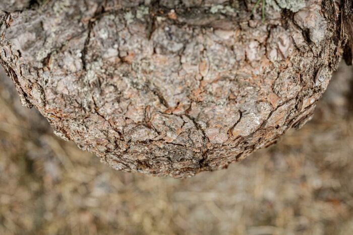 Keuhkoahtaumataudin aiheuttama tautitaakka on merkittävä Suomessa